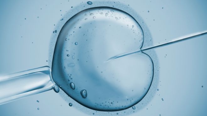 In-Vitro-Fertilization